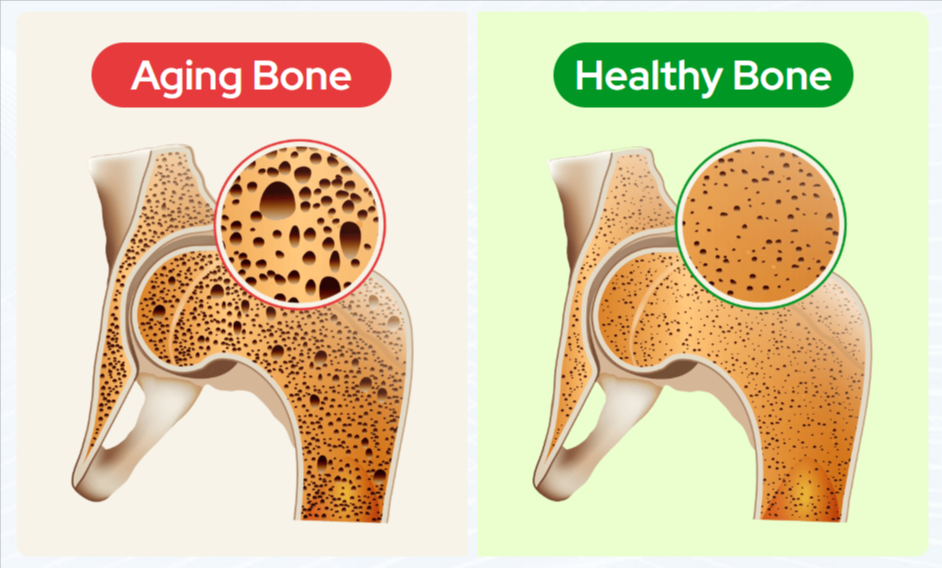 Biocal Bone Support-Benefits