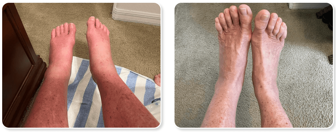 NativePath Antarctic Krill Oil-Benefits